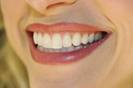 images (20)