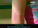 Dill Mil_1678_00010001