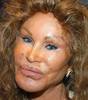 Jocelyn Wildenstein