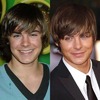 zac-efron-plastic-surgery