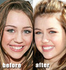 miley_cyrus_gummy_smile